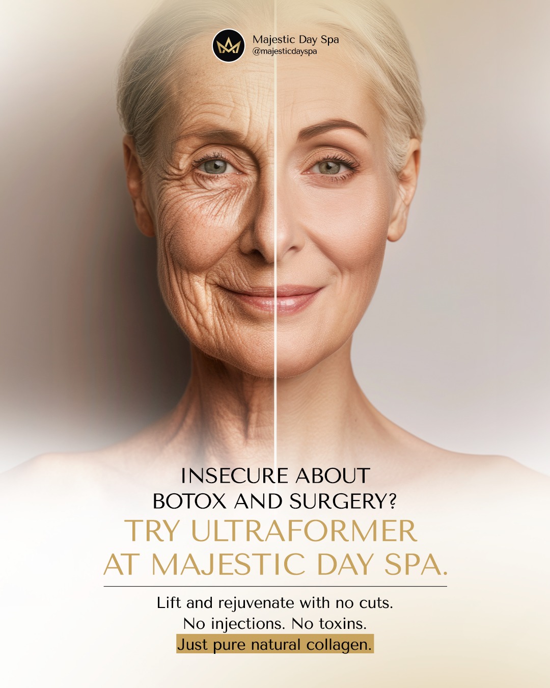 Botox and Facelift are being considered for many for anti aging treatments and rejuvenating solutions. But we can tell you: there’s a safe and efficient result that is non invasive, with no cuts, no injections and no toxins: the amazing Ultraformer.
While FaceLift might give you a hard recovery time and botox is a toxin that temporarily paralyzes muscles, Ultraformer works with you and for you. It uses advanced ultrasound energy to **heat deeper layers of skin**, triggering **your own collagen and elastin production**. The result is a naturally lifted, firmer skin in no downtime.
It’s safe, it’s subtle and it’s incredible. Your face still looks like you, just more youthful.
📅 Discover more about this amazing procedure. Come in for a consultation. At Majestic Day Spa, we offer clarity with the premium attendance you deserve