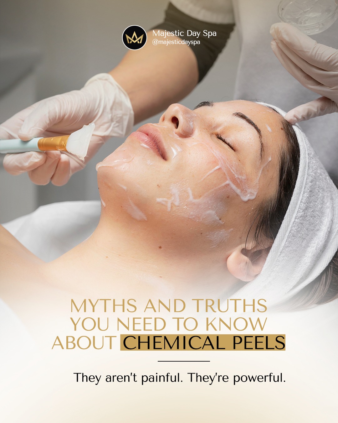 Want to know the truth? Chemical Peels are often misunderstood.
You’ve probably heard things such as:
“Your skin will peel off in sheets.”
“You’ll look red and raw for days.”
“It’s only for serious skin problems.”
Well, we are here to show you what these people may not know:
Myth: They’re painful and leave your skin raw.
Truth: In expert hands, a professional peel is a controlled, safe resurfacing process that gently lifts dead skin, brightens the complexion, and encourages collagen renewal. No drama, just visible results.
Myth: Only for severe skin issues.
Truth: We customize peels to your skin’s current state — from sensitive skin needing a refresh, to mature skin needing firmness and clarity.
At Majestic Day Spa, we use advanced formulas and refined techniques that minimize downtime while maximizing results. Our licensed aestheticians are here to demystify the process and guide your journey to smoother, more radiant skin.
📅 Curious about the peel that’s right for you? Let’s talk. Your new skin is waiting.